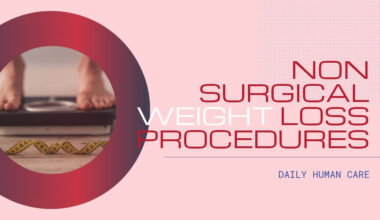 Non-surgical weight loss procedures