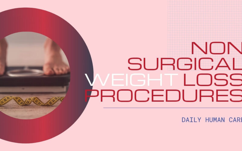 Non-surgical weight loss procedures