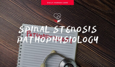 spinal stenosis pathophysiology