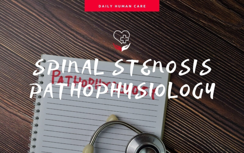 spinal stenosis pathophysiology