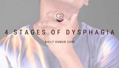 4 stages of dysphagia