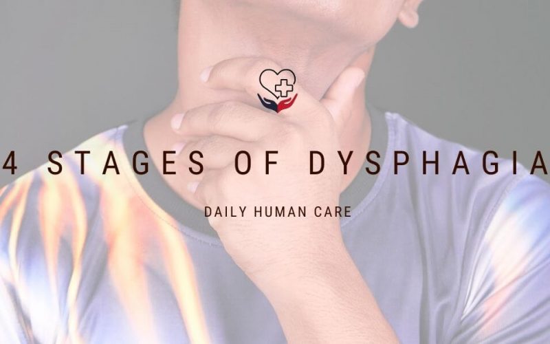 4 stages of dysphagia