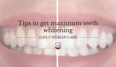 Tips to get maximum teeth whitening