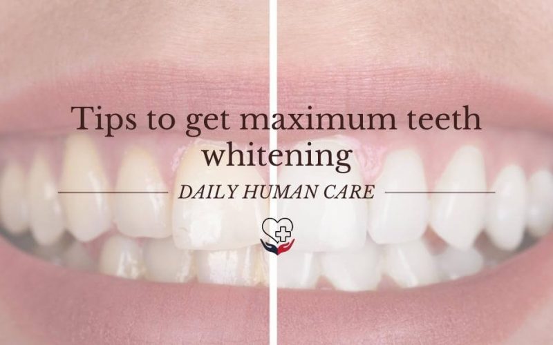 Tips to get maximum teeth whitening