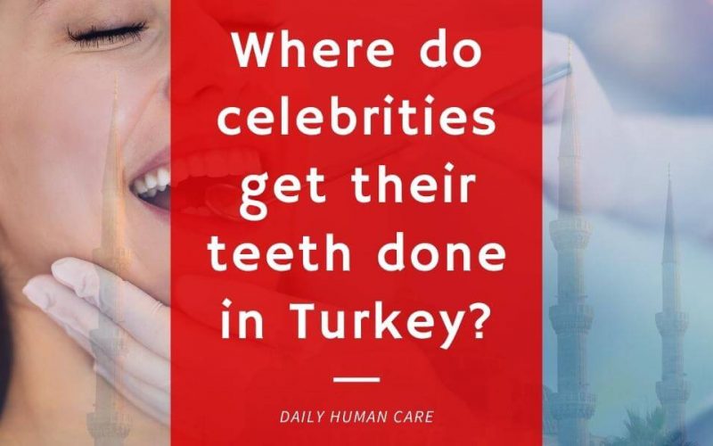 Where do celebrities get their teeth done in Turkey?