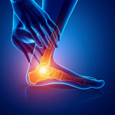 Ankle pain 