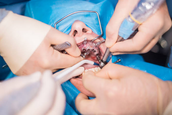 Dental Surgery Techniques